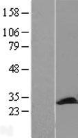 PCMT1 Human Over-expression Lysate