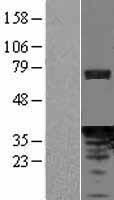 PDCL Human Over-expression Lysate