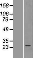 AMPK beta 2 (PRKAB2) Human Over-expression Lysate