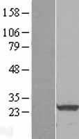 RALA Human Over-expression Lysate