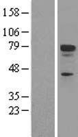 p73 (TP73) Human Over-expression Lysate