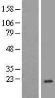 TNP2 Human Over-expression Lysate