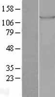 TIE1 Human Over-expression Lysate