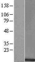 TAL2 Human Over-expression Lysate