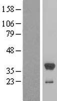 Estrogen Sulfotransferase (SULT1E1) Human Over-expression Lysate