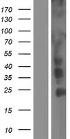 CCDC6 Human Over-expression Lysate