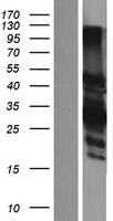 CER1 Human Over-expression Lysate