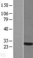 DNAJB6 Human Over-expression Lysate