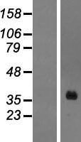 HOXA1 Human Over-expression Lysate