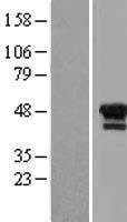 LIM1 (LHX1) Human Over-expression Lysate