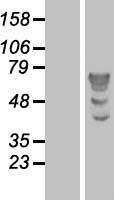 TBL1 (TBL1X) Human Over-expression Lysate