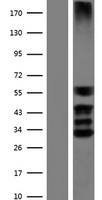 SOX3 Human Over-expression Lysate