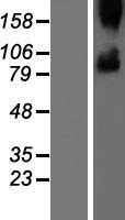 Smoothened (SMO) Human Over-expression Lysate