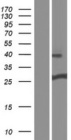 DGCR6 Human Over-expression Lysate