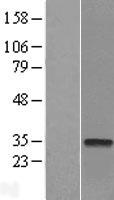 CTDSP2 Human Over-expression Lysate