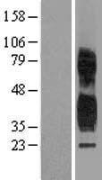 TSPAN1 Human Over-expression Lysate