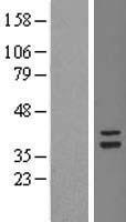 TSFM Human Over-expression Lysate