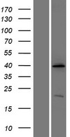 ATP6IP2 (ATP6AP2) Human Over-expression Lysate