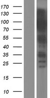 KAP1 (TRIM28) Human Over-expression Lysate