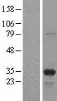 PSME3 Human Over-expression Lysate