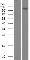 TSHZ1 Human Over-expression Lysate
