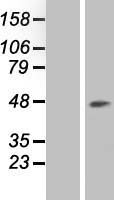 RNA terminal phosphate cyclase like 1 (RCL1) Human Over-expression Lysate