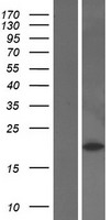 Peroxiredoxin 2 (PRDX2) Human Over-expression Lysate