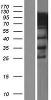 hnRNP R (HNRNPR) Human Over-expression Lysate