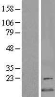 CDK2AP2 Human Over-expression Lysate