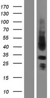 Sprouty 3 (SPRY3) Human Over-expression Lysate