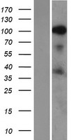 SRRM1 Human Over-expression Lysate
