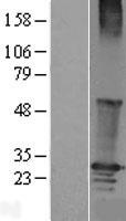 RGS19 Human Over-expression Lysate
