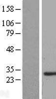SMNDC1 Human Over-expression Lysate