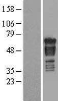 PAK4 Human Over-expression Lysate