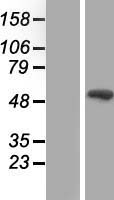 SMAD9 Human Over-expression Lysate