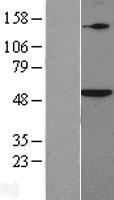 SMAD5 Human Over-expression Lysate