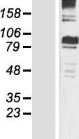 MTHFR Human Over-expression Lysate