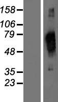 hCAP D3 (NCAPD3) Human Over-expression Lysate