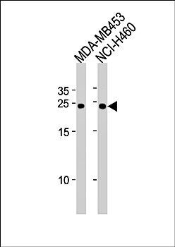 BCAP31 antibody