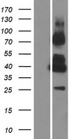 GPRC5C Human Over-expression Lysate