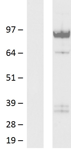 PCDHGA11 Human Over-expression Lysate