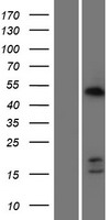 CDCA7 Human Over-expression Lysate
