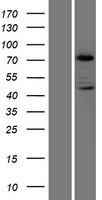 PKC beta 1 (PRKCB) Human Over-expression Lysate