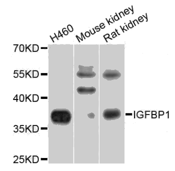 IGFBP1 antibody