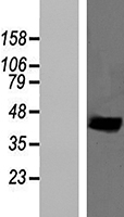 B4galt4 Mouse Over-expression Lysate