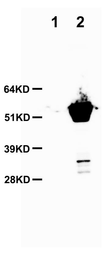 SARS-CoV-2 N Protein Virus Over-expression Lysate