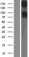 CD22 Human Over-expression Lysate