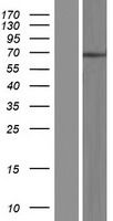 NT5C1B (NT5C1B-RDH14) Human Over-expression Lysate