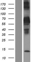 SCHIP1 Human Over-expression Lysate