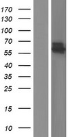 C14orf133 (VIPAS39) Human Over-expression Lysate